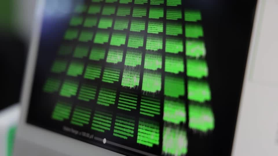 This computer runs on living human brain cells | Reuters