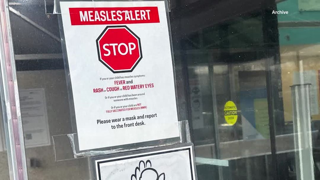 US CDC works on standard definition for measles deaths as cases rise ...